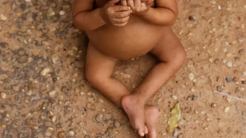 Casos de baixo peso aumentam na Bahia e superam média do país