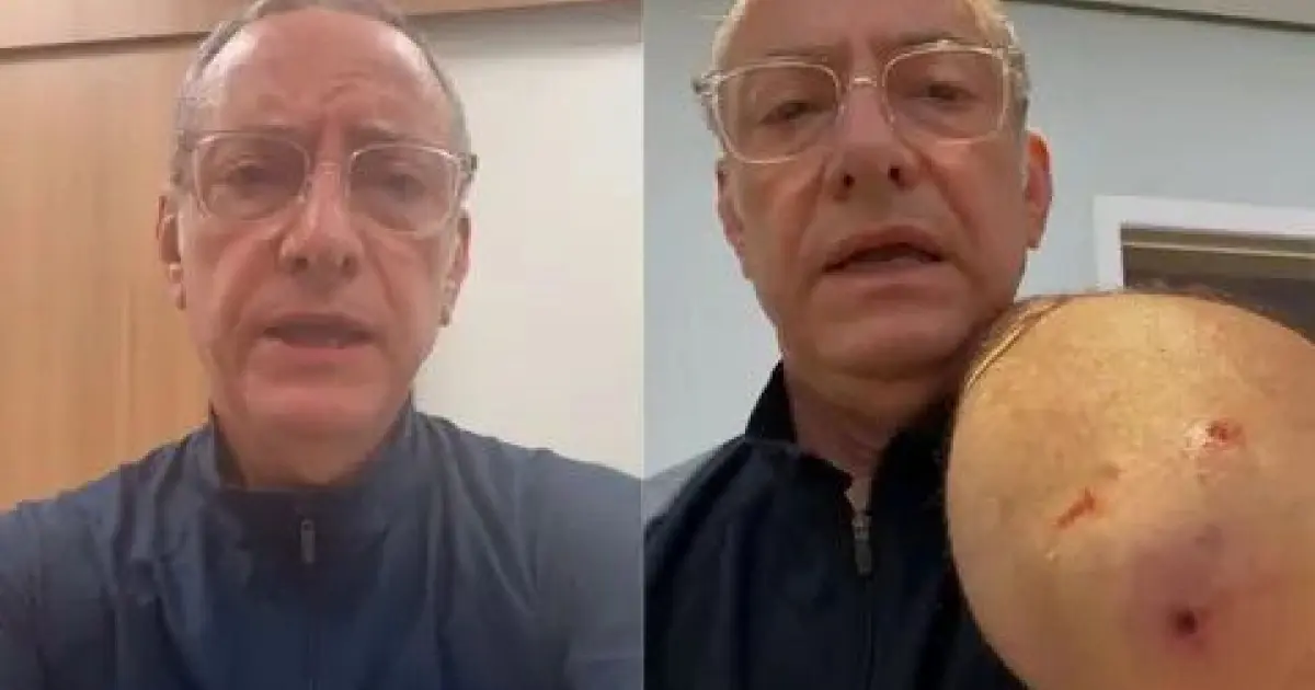 Apresentador José Roberto Burnier leva quatro pontos após ataque de pitbull em São Paulo